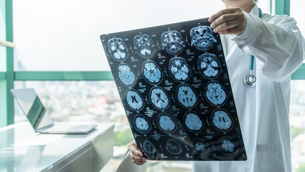 CreateAbility Celebrates National Brain Injury Awareness Month